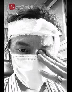  耳朵|男子街头阻止性侵被咬掉耳朵 无法修复只能开颅