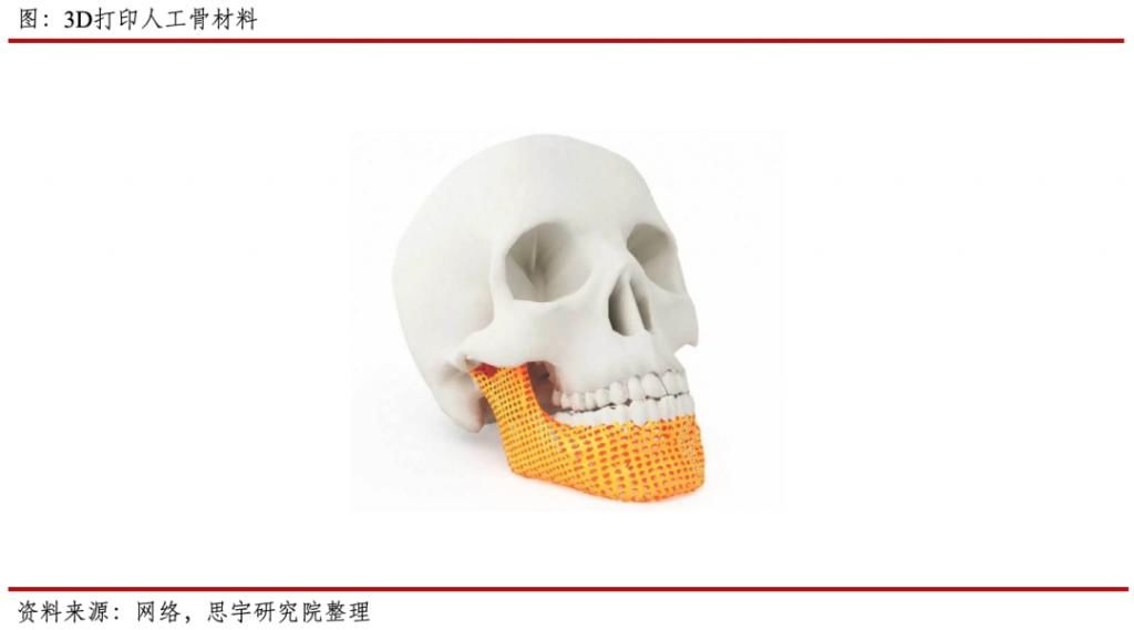 骨会|行业｜需要骨修复的患者越来越多，人工骨会是他们的救星吗？