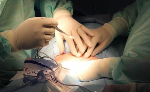  举动|男子把40厘米长的黄鳝塞进自己体内，是什么让他有如此的惊人的举动？