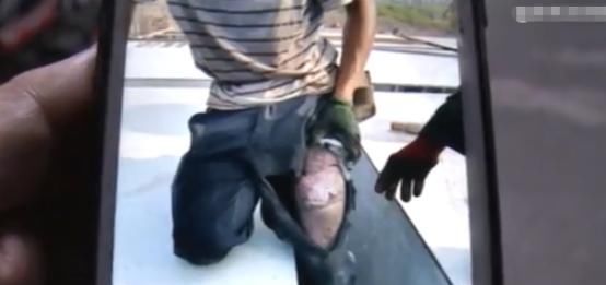  厂家|手机放裤兜自燃？工地一男子不幸烧伤左大腿，厂家着急撇清关系