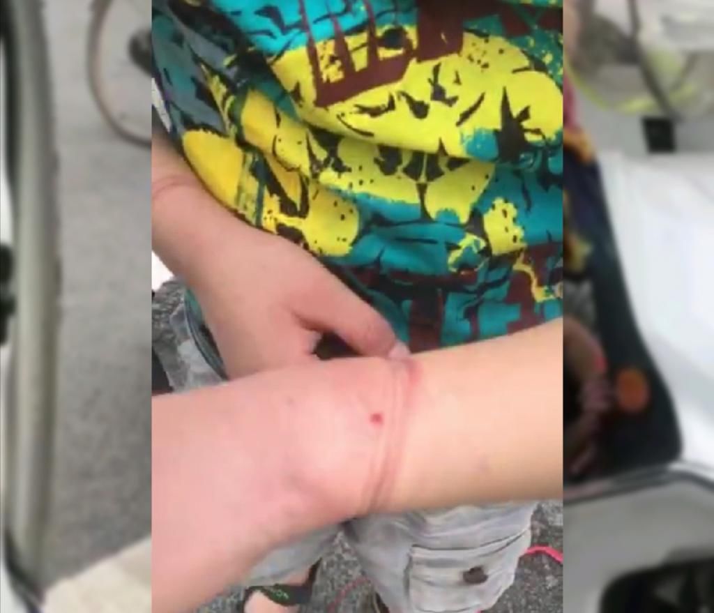  绑住|女子将9岁儿子绑住手脚塞在电动车座下方，孩子手发紫，胳膊出血