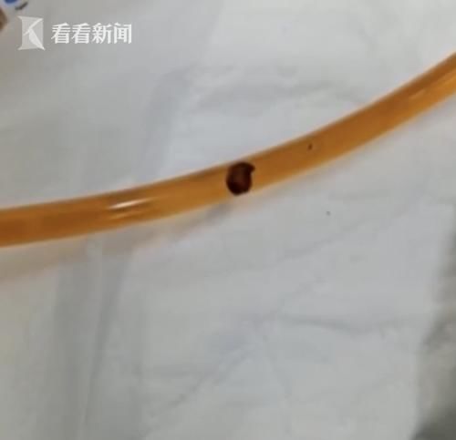  体内|男子体内排出20多条活虫 竟跟常吃这道菜有关！