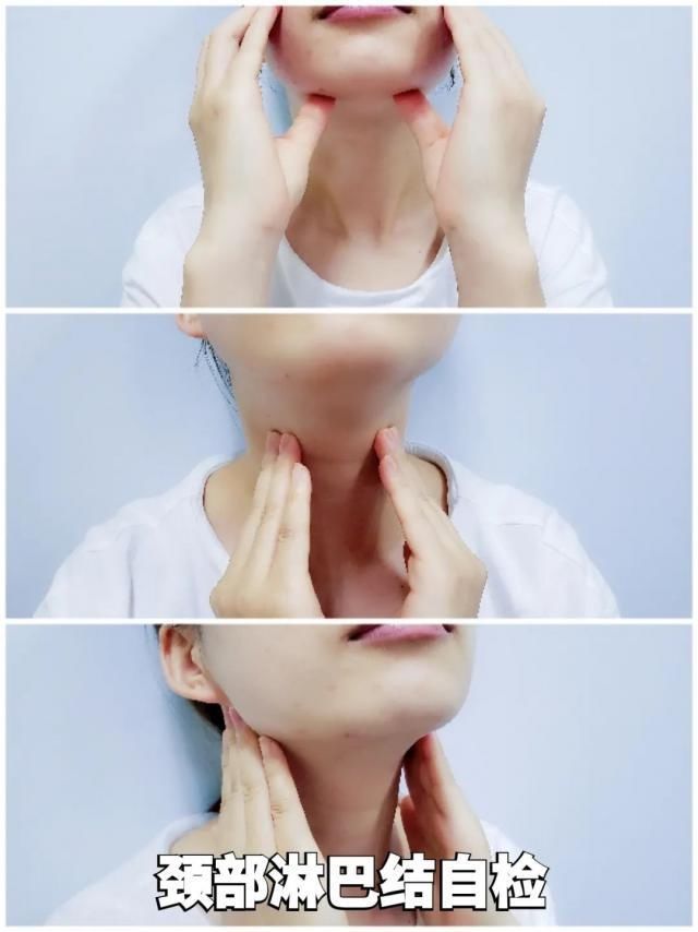 脖子|年轻姑娘在脖子上突然摸到一个包！脖子还越来越粗
