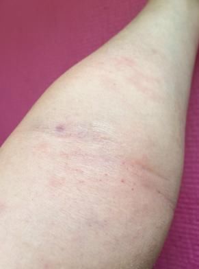 部位|怎样坚持拍打同一个部位一小时?