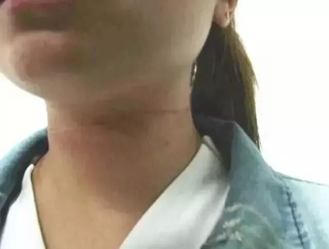  女孩|飞来横祸！浙江一名23岁女孩骑电动车惨遭“割喉”，罪魁祸首万万想不到