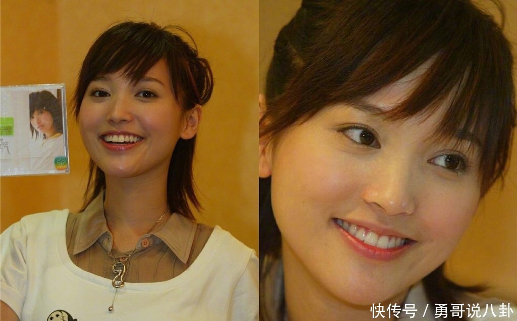 正骨|金莎硬核澄清整容谣言！脸部正骨听说过吗隔着屏幕都觉得脸疼