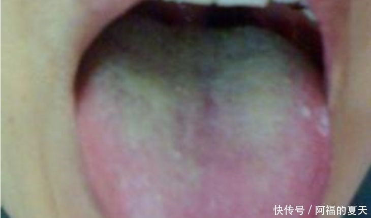  求助|伸出“舌头”，若出现4种“状况”，可能是在向你“求助”！