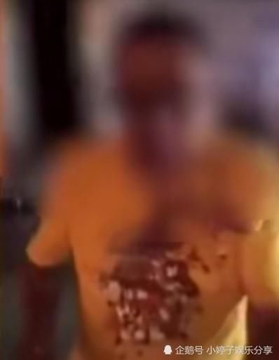 医药费|你是不是瞧不起我?外面小哥将挑衅者打出血:医药费3千,他却叫我赔7万