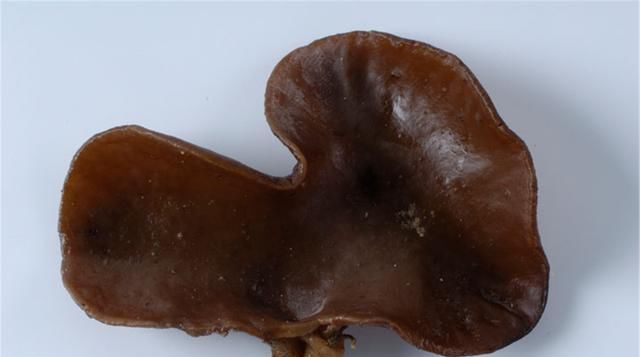  做法|木耳家常创新做法，打上两个鸡蛋，出锅后没想到这么好吃