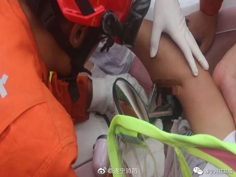  刺穿|看到都痛！男子骑电动车撞到半挂车，右手被刹车把手刺穿