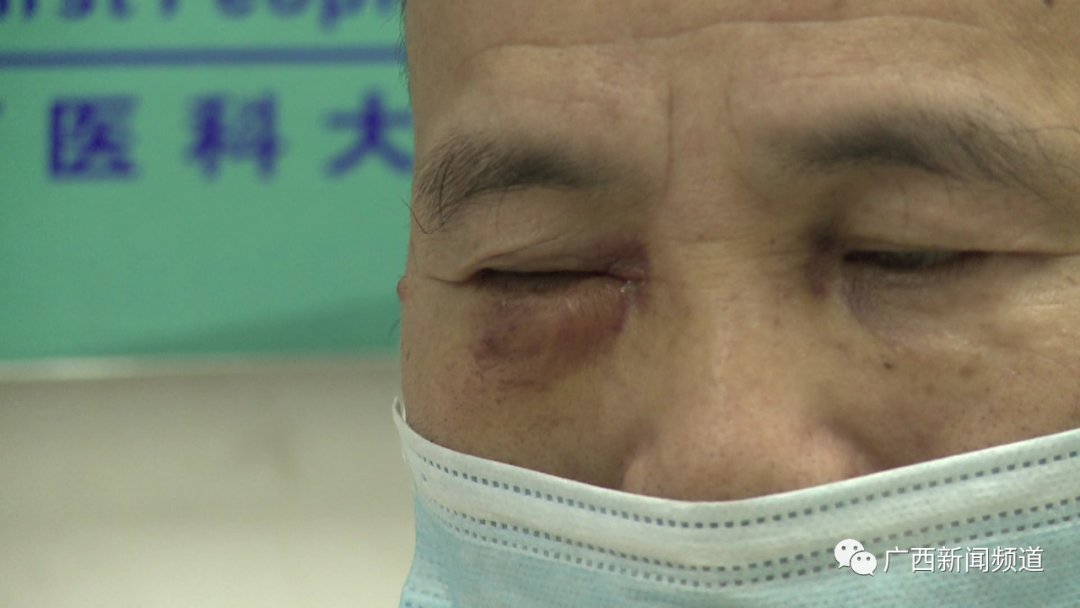 保安|“我爸是公安局副局长！”男子不肯挪车还狂殴57岁保安半小时，视频看气炸！结果一查…