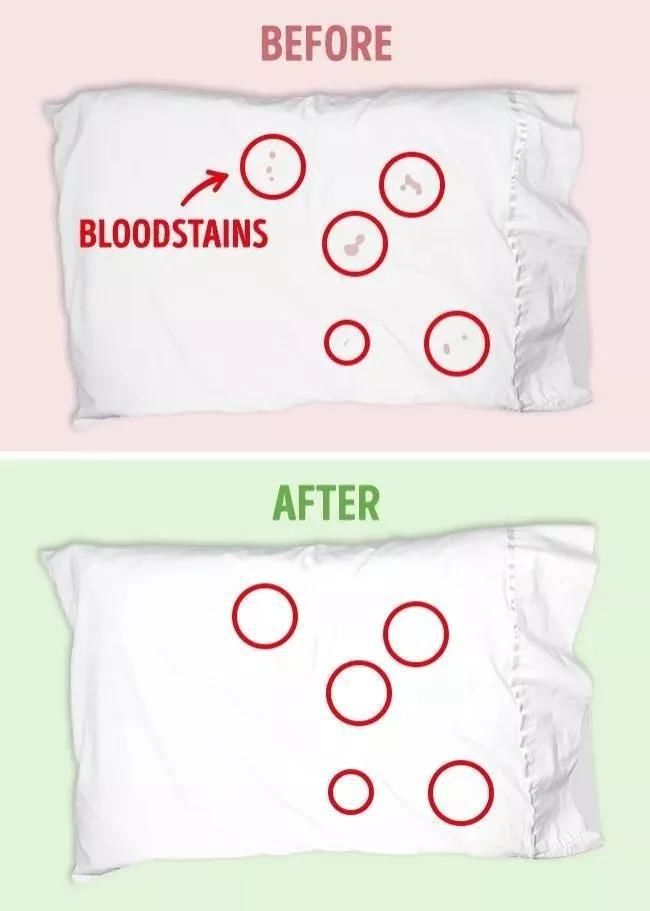 发黄|衣服发黄，别用漂白剂了，水里加点它，比新买的还干净！