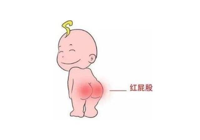  宝宝|宝宝红屁股怎么样好得快？你或许真的不知道，看看育儿专家的理解