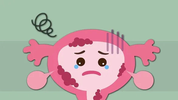  输卵管|做试管婴儿, 遇到这些情况不要着急移植, 小心造成胚胎浪费