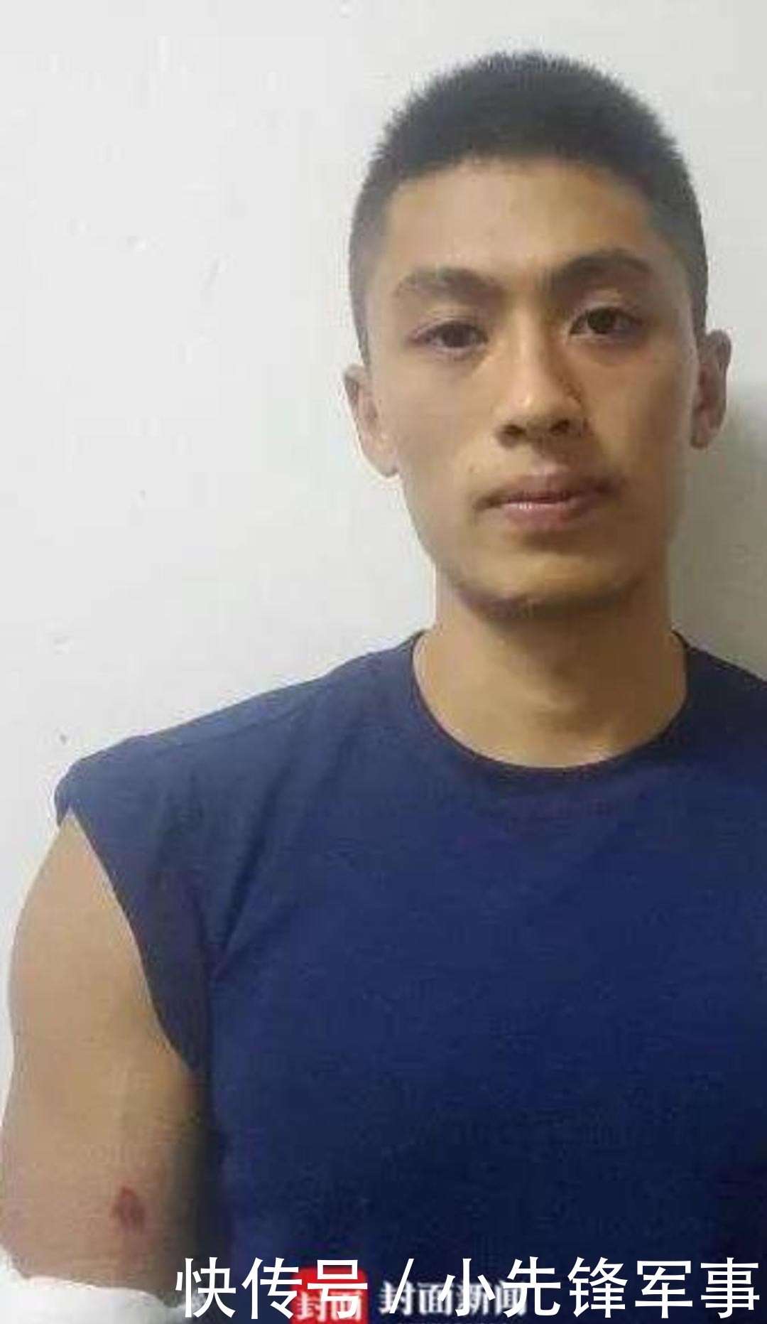  王芳|消防人员沱江边救轻生女子 反被女子咬伤手臂