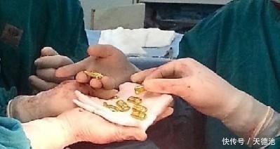 走私案件|印度走私团伙趁疫情加大走私力度,三斤黄金藏内裤,不愧是印度人!