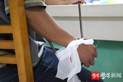  擅自|螺旋型钢管插入手臂， 25岁小伙没有擅自拔管“非常正确”