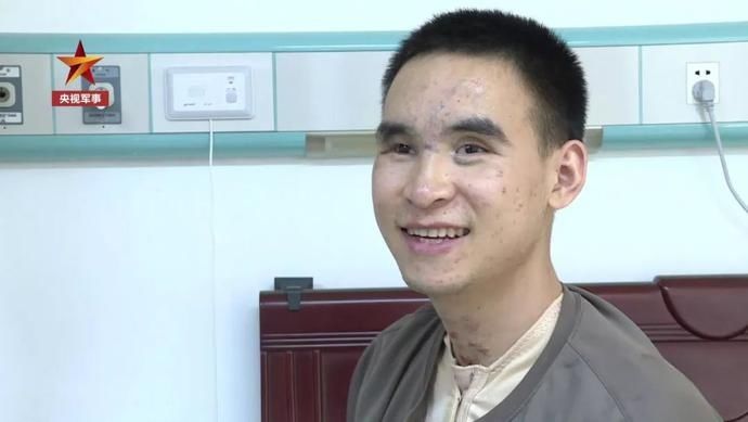 场上|在雷场上失去双手双眼的英雄,如今怎么样了?