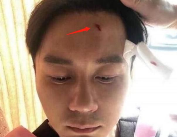  季跑|录制8季跑男从未缺席的人，不是陈赫不是李晨，而是变化最大的他