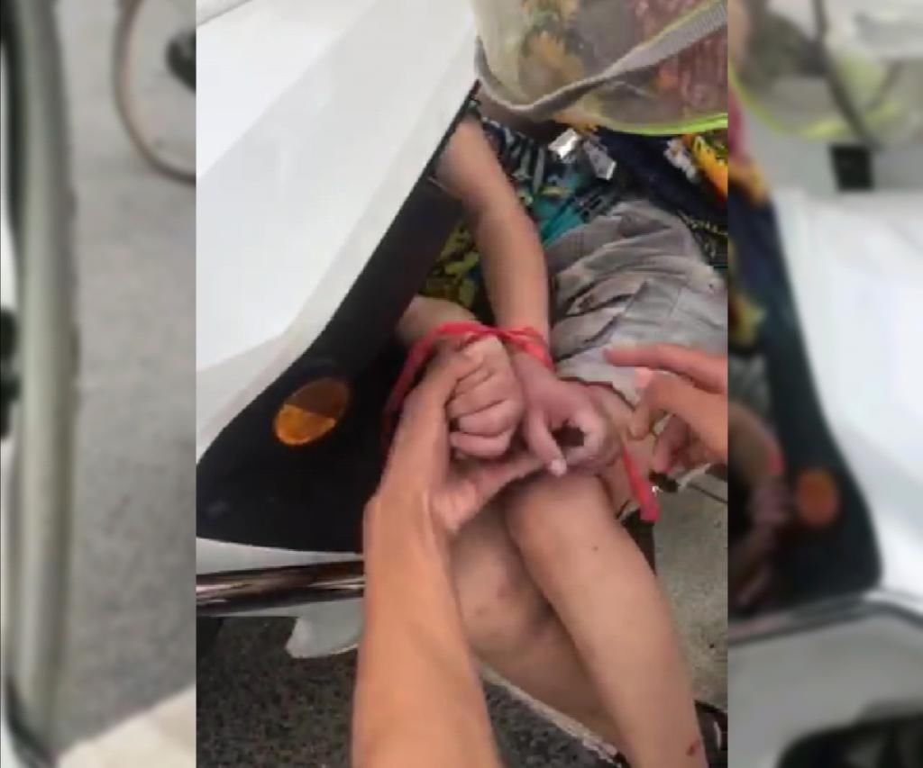  绑住|女子将9岁儿子绑住手脚塞在电动车座下方，孩子手发紫，胳膊出血