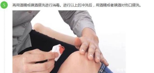  昏迷|2岁男童昏迷10多天 很多孩子都喜欢这么做