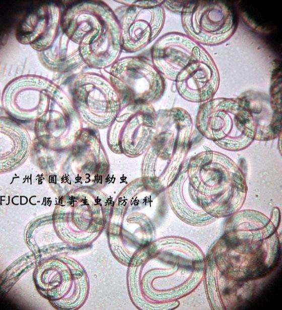  当成|洱海惊现外来物种，携带6000多条寄生虫，却被国人当成餐桌美味