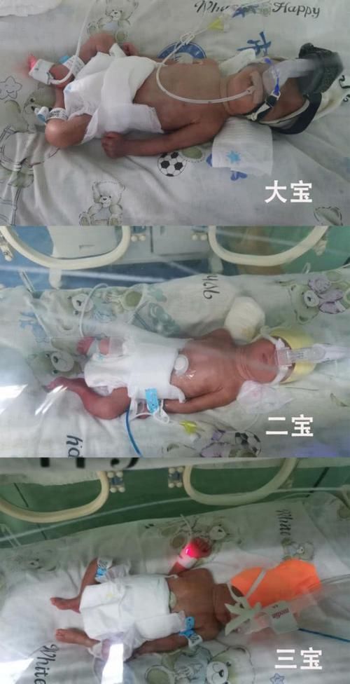宝妈|97年宝妈成功生下3胞胎，却终日以泪洗面，原因是担心名字用不上