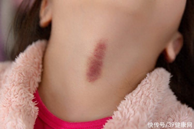 男女亲热时，身体3个部位是禁吻区，为了伴侣健康，不要轻易触碰2023