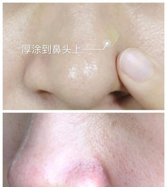 绿豆泥面膜|发现鼻子上的小颗粒越来越多,怎么办?