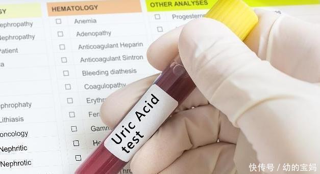 放在|减少尿酸的四大秘诀是戒酒,很少有人会把它放在第一位!