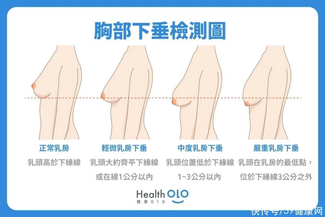 长期不穿内衣的女生，身体会发生哪些变化？希望你不要羞于了解2023