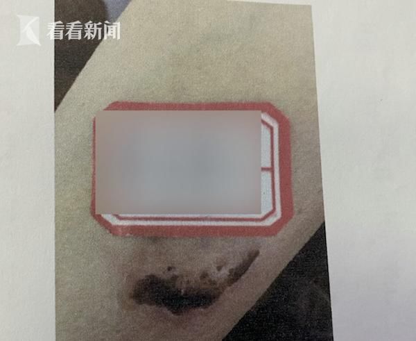 辩称|男子大闹法院还咬伤法警！庭上辩称：我有精神病