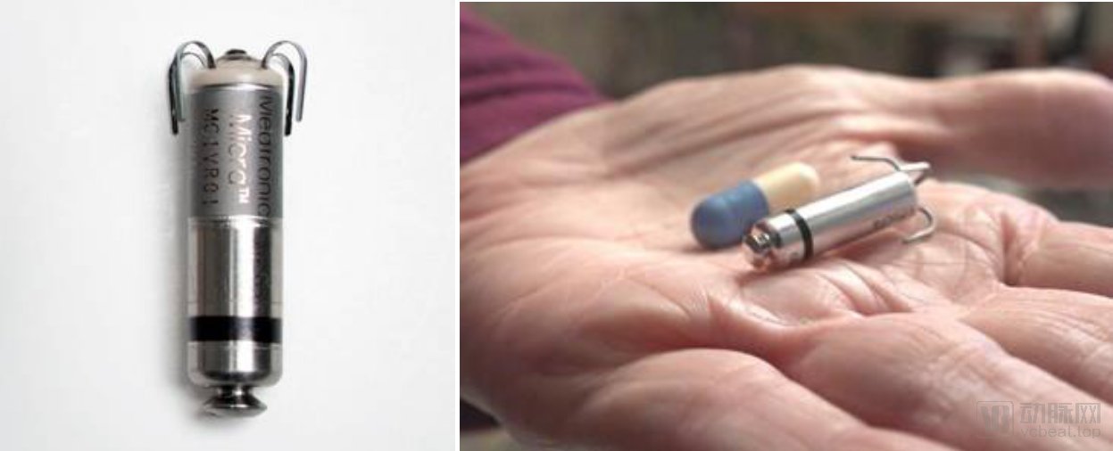 重点|“2021年度十大医疗创新”出炉，这些领域值得重点关注