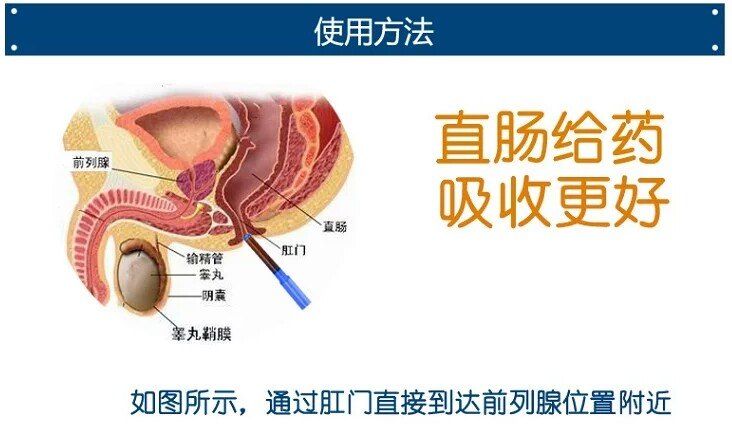 直肠给药 儿科绿色疗法