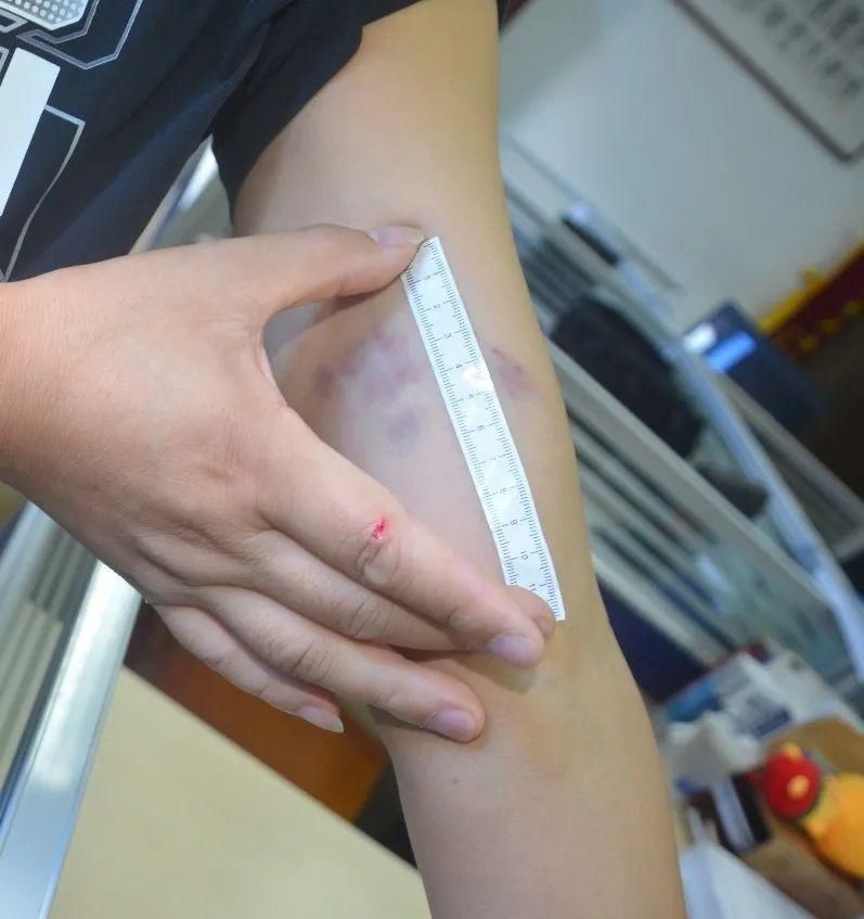 张兴猛|头盔与危险，20元与犯罪，你怎么选择！