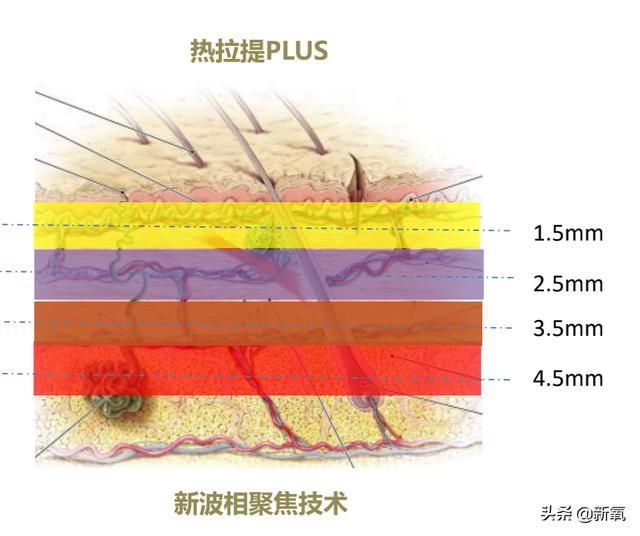  产后|高圆圆复出有点坎坷，产后1年首次亮相网友们为这生图吵翻天