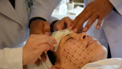  医生|皮肤科医生科普热玛吉——操作过程及患者问答，看完就不懵了