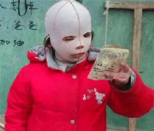 同学|女孩因一直戴“头套”上学,受尽同学嘲笑,摘下头套后众人沉默了