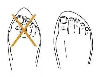  截肢|男子险被截肢，凶手竟是一条鱼！只因忽视了…