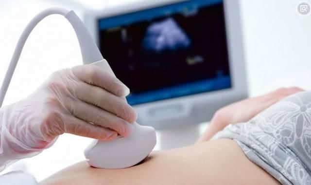  检查|对于B超检查，80%的孕妈妈都会有这样的3种误解，快来看看吧