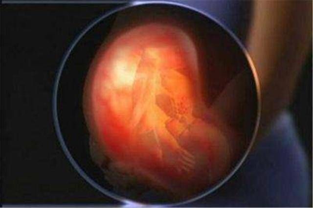 发育不良|三种表现暗示胎儿发育不良,七种原因需自查,及时去医院别大意