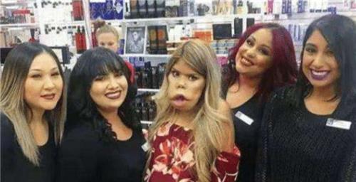 少女|印度少女因长相神似猴头走红,被富豪明媒正娶回家后,现怎样?