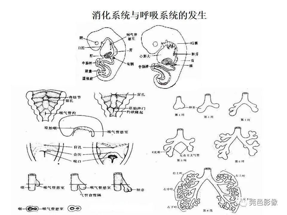 畸形|胃重复畸形CT诊断与鉴别诊断