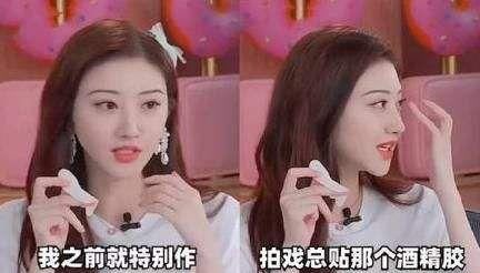  割双眼皮|景甜双眼皮埋线失败，你还在随便选择医美医院吗？丨科普篇