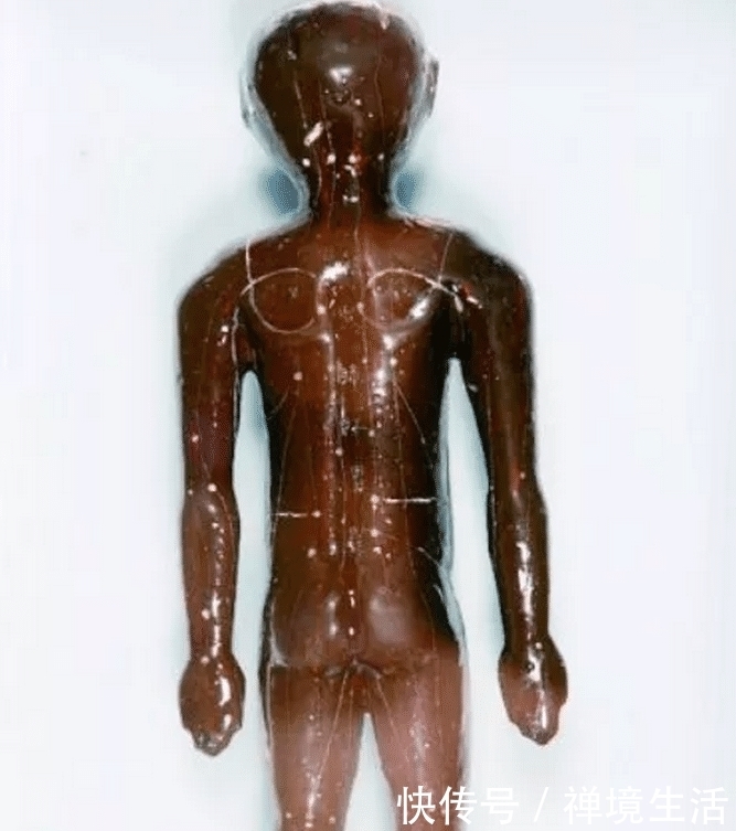 经络漆人|上古“神医”扁鹊,历史上真实存在吗?听考古学家怎么说