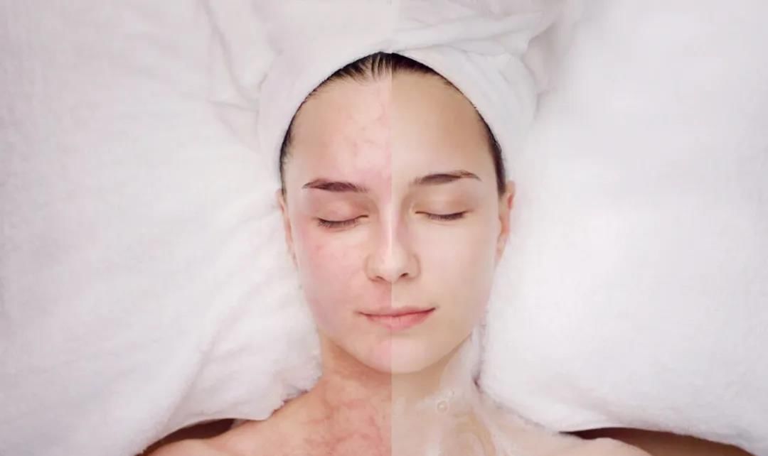  DMK|DMK刷酶法的作用机理和主体血与氧