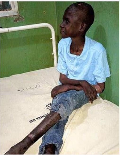  布林|这还是父母？非洲男孩被亲爹和后妈锁鸡棚两年，靠吃自己的粪便为生