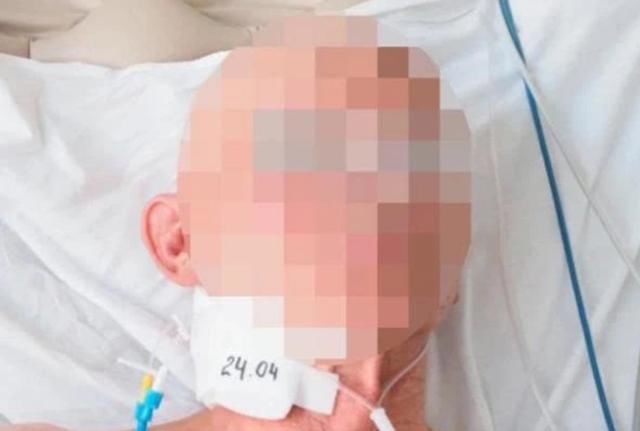  小时|醉汉冰封6小时成冰棍，被医生用5000伏高压电击24次救活