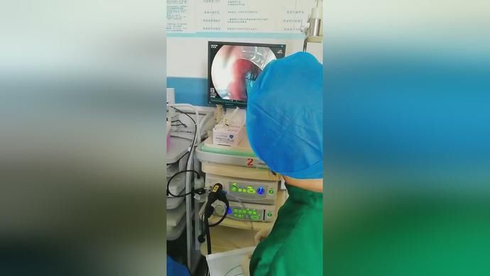  危险|危险！广南一人冲动吞下一枚燕尾夹